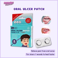 Ulcer Patch ubat ulser mulut Pelekat Ulcer Mouth Oral ulser patch for treatment