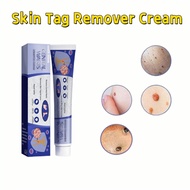 skin tag remover cream ellgy corn and warts corn remover plaster buang tahi lalat ubat kutil ubat ke