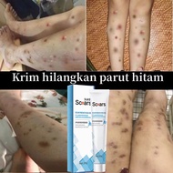 krim parut kaki Krim hilangkan parut Hilangkan parut kaki Parut hitam Bites Scratches Stretch Marks 