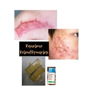 Pimple and keloids kanolones liquid remover