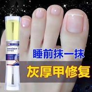 United States/Authentic/Bright Nails-Used 1-2 Times a Day-Does Not Hurt Good Nails-Nutrient Solution