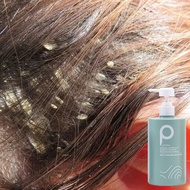 Psoriasis Scalp Itchy Scalp Shampoo Hair Shampoo Itchy Scalp Skin Problems
