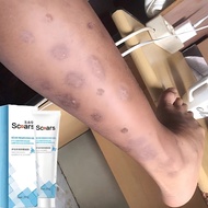 Krim hilangkan parut Hilangkan Parut kaki Krim hilangkan parut hitam removal Stretch Marks Burns Sca