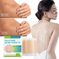 Silicone Gel Strips Patch Silicone Scar Sheets Reusable Silicone Scar Removal Patch Remove Trauma Bu