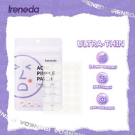 Ireneda Ultra-Thin Acne Pimple Patch 24 Patches