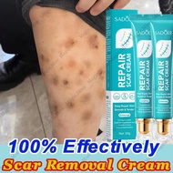 scar remover peklat remover cream for old scar on leg stretch mark remover acne scar remover peklat 