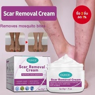Scar Removal Cream Scar Removal Cream Foot Scar Repair Scar Removal Cream Old Scar Repair CZNW