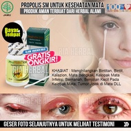 OBAT PENGHILANG BENJOLAN DI KELOPAK MATA - OBAT MATA BINTITAN - TIMBILEN - KALAZION - MENGHILANGKAN 