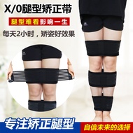 Adult and Children Leg Shaper X Shaped Leg O Leg Shaping Strap Leg Band Leg Binder Strap Wide Leg Ar