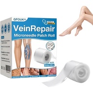 Gfouk Vein Repair Roller-2.4 Inch, 59 Inch Long.