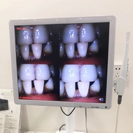 Camera Wifi HD 8 Million Pixels High-definition Endoscope Tools 17 Inches Digital LCD Monitor Intrao