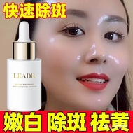 whitening cream  美白霜   377小白瓶祛斑精华液烟酰胺美白护去斑霜色斑雀斑点老年斑黄褐斑