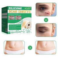 Silicone Scar Removal Tablets Effective Scar Repair Sticker F8B0
