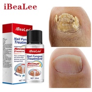 IBEALEE NAIL FUNGUS TREATMENT merawat kulat kuku penghapus kulat kuku vitamin kuku pengilat kuku can