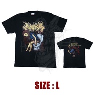 TS - INOPEXIA - Myocardical Biopsy Had A Lethal Outcome