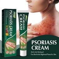 【20g】Care Anti-Itch Cream Herbal Chinese Medical Skin Treatment Cream