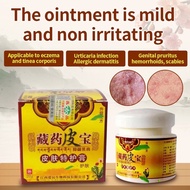 Krim gatal kulit/ubat panau mujarap/ubat gatal/eczema treatment/ubat gatal cina/cream gatal kulit/ubat kurap dan gatal