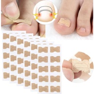 20pcs Toe Nail Corrector Patch Ingrown Toenail Correction Stickers Glue-free Ingrown Toenail Correct