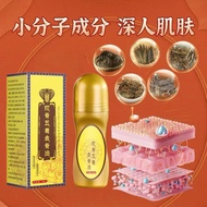 Snake Bone Five Poison Golden Bone Oil Gentle Soothing Moxibustion Liquid zhizhuip71