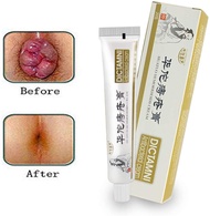 Hemorrhoids Ointment Cream Chinese Medicine HuaTuo Shrink Swollen Hemorrhoid Tissue Reduce Heat and Inflammation Relieve Hemorrhoid Pain Clear Away Toxic Materials Remove Decayed Tissues [KOREAN GIRL]