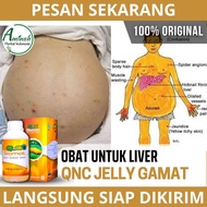 Obat Liver Tradisional - Obat Liver Perut Membesar - Obat untuk Liver Bengkak - Obat Liver Akut - Ob
