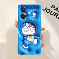 ( BC04 ) OPPO A3X Softcase A3/ - OPPO A3X Case A3/ - Silicone - Star Case88 - Pro Camera Softcase - 