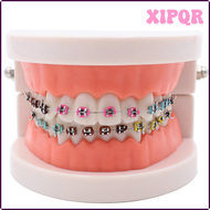 รูปแบบการรักษาอุปกรณ์จัดฟัน XIPQR กับกายอุปกรณ์ราวโลหะลวดโค้งเส้นเอ็นทันตแพทย์ฟันปลอม SXAPI