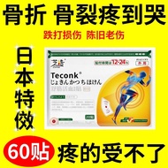 骨折骨裂贴接骨伤跌打损伤脚崴手腕扭伤肌肉韧带拉伤消肿止痛膏贴Fracture, bone fracture, bone patch, bone injury, fall, injury, ankle 