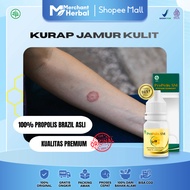 Propolis Ringworm Medicine, Itchy Skin Medicine - Tinea Versicolor - Ringworm - Ringworm - Athlete's