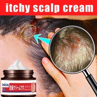 Itchy scalp cream Seborrheic dermatitis cream scalp treatment psoriasis folliculitis scalp tinea dan