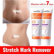Stretch Mark Skin Repairing Cream Women'S Postpartum Moisturizing Body Treatment Cream 40g Stretch M