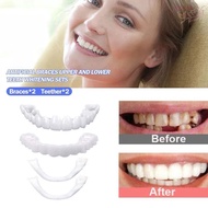 JWENTY Upper Lower Fake Tooth Perfect Smile Women Silicone Temporary Orthodontic Braces Denture Brac