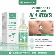 Dermalab Serum Muka 30ml Emu Renew Serum | Repair sunken scars Fade Spot Acne Mark & Bekas Luka，Sesu
