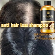 Hair Loss Shampoo anti hair fall shampoo hair loss shampoo 300ml shampoo anti hair fall powered by g