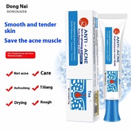 冬奈儿草本祛痘膏 quality product herbal  acne cream fade acne marks special for beauty salon anti-acne cream