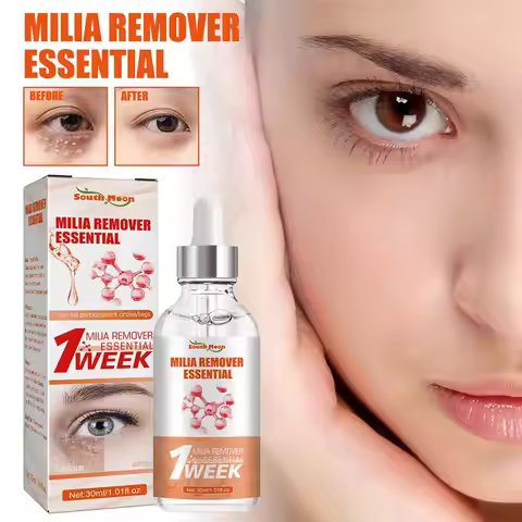 30ml Eye Fat Granules Removal Serum Effective Anti-Particles Eye Cicle Line Fine Fade Improve Serum 