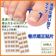 其他品牌 - 趾甲貼片 腳趾矯正器 指甲貼 指甲矯正貼 正甲貼 甲溝嵌甲矯正器