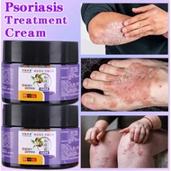 cream gatal kulit eczema cream krim gatal kulit krim gatal kulit herba cina psoriasis cream Skin mos