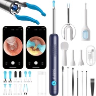 BEBIRD R1 Ultra Ear Wax Removal: 1296P HD Ear Camera Cleaner Tweezers IP67