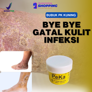 Peka Obat Gatal Buat Mandi - Peka Pk Obat Gatal Serbuk Untuk Cacar Air Warna Biru Kuning
