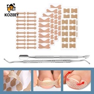 [KOZEEY] Ingrown Toenail Correction Patch Versatile Efficient for Ingrown Toenail Remover with 2 Ped