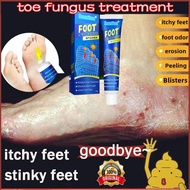 ubat kulat kaki Foot fungus beriberi ubat kaki berbau Kulat air Kaki gatal berbau Inhibit foot odor 