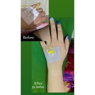 infus whitening