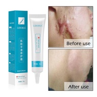 LIDUOLIYA 20g Skin Smoothing Cream Repair Essential Liquid Hydrating Remove Pimple Marks Skin Care S