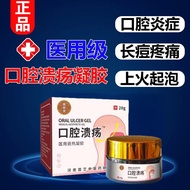 [Official Authentic] Oral Ulcers Gel Lips Foaming Fire Long Acne Reduce Swelling Relieve Pain Oral Ulcers Antipyretic z5.1