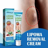 Freego Lipoma Removal Lipoma Fatty Removal Lipoma Removal Balm, Herbal Lipoma Lumps Removal Cream, G