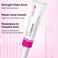 【คลังสินค้าพร้อม】15% Azelaic Acid A-Cne ครีมกำจัด Salicylic Acid Shrink Pores Refining Cream Blackhead Remover Oily Skin Care