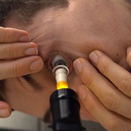 S5 Mini™: for Easy and Accurate Scleral & Hybrid Lens Insertion - Perfectly Align Your Eye with The 