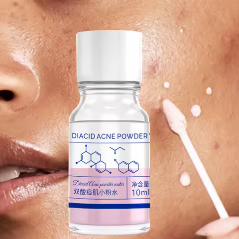 10ml pink salicylic acid concentrated acne essence - containing salicylic acid, lactose acid, calami