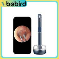 Bebird Note 5 Pro | 10MP | Smart Visual Ear Sticks | Ear Pick Tool With Camera | Waterproof | Otosco